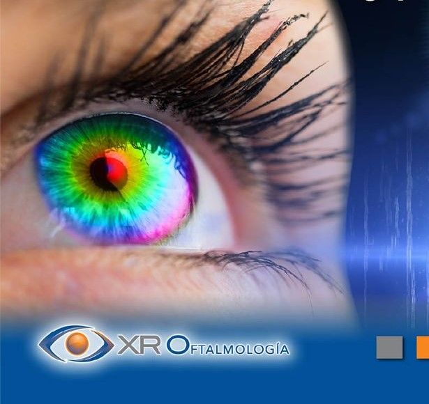 Xi Rao-0