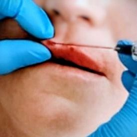 Dalgiza Silva, Fisioterapeuta São Carlos