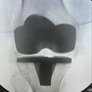 Ampliar imagem: Eder Magro Pereira, Ortopedista - Traumatologista São Paulo