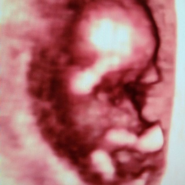 Tisbeth Abreu Martínez, Ginecólogo Santiago