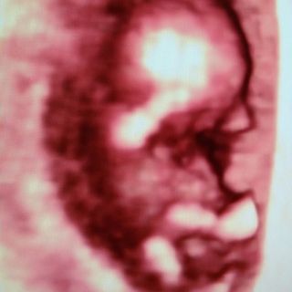 Acercar imagen: Tisbeth Abreu Martínez, Ginecólogo Santiago