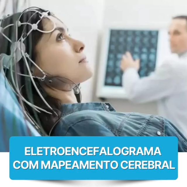 Exame Eletroencefalograma