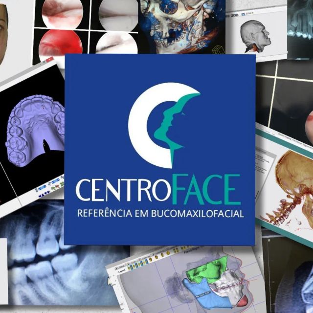 Sinval  Vinicius Barbosa do Nascimento, Cirurgião buco-maxilo-facial Recife