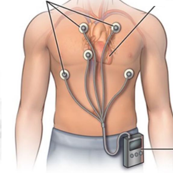 Exame Holter 24 horas