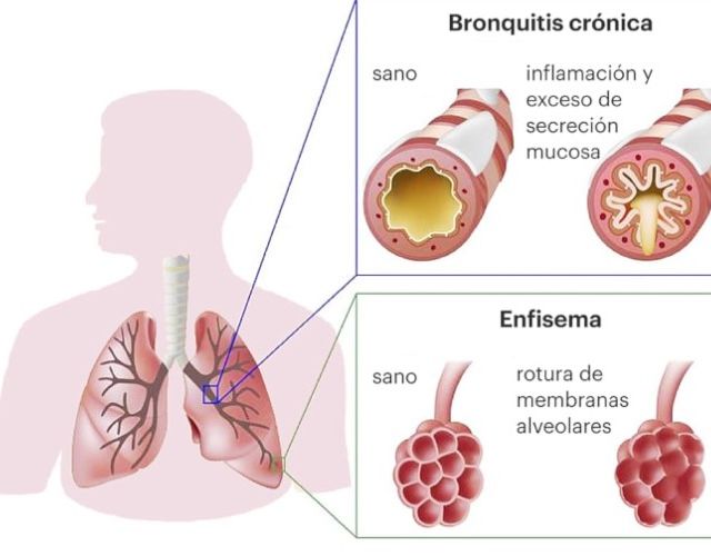 Ana Cristina Villarreal Jaramillo, Neumólogo Pasto