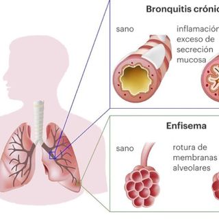 Ana Cristina Villarreal Jaramillo, Neumólogo Pasto