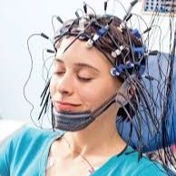 Ampliar imagem: Exame Eletroencefalograma , Técnico em análises clínicas Irecê