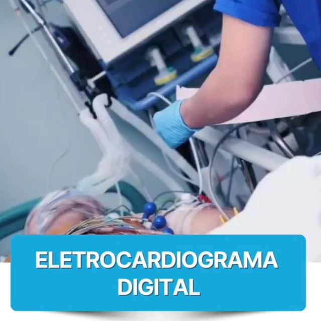 Exame Eletrocardiograma