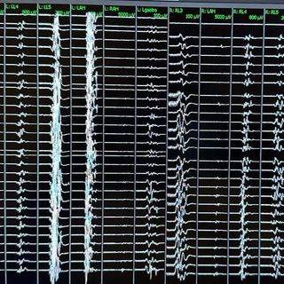 Ampliar imagem: Luis Augusto Avansini Carnelos, Neurologista Campo Grande