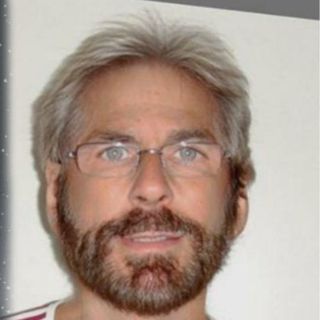 Ampliar imagem: Marco Antonio de Almeida, Oftalmologista Rio de Janeiro