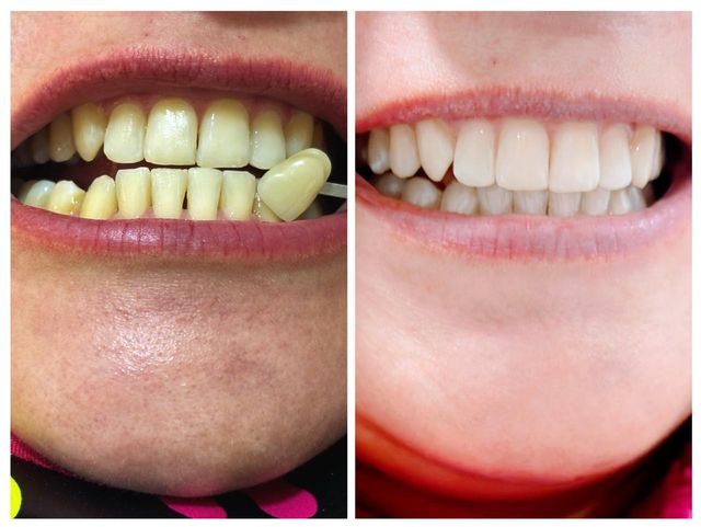 Acercar imagen: Consulta online