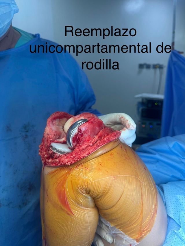 Acercar imagen: CONSULTA DE ORTOPEDIA DR JOSE VICENTE REY