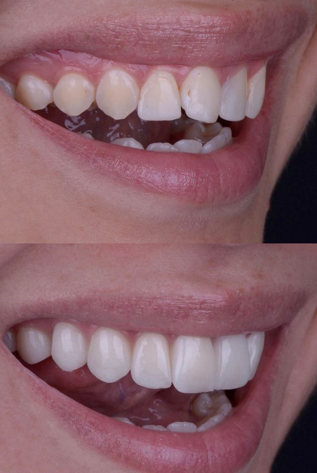 Acercar imagen: Consultas en línea