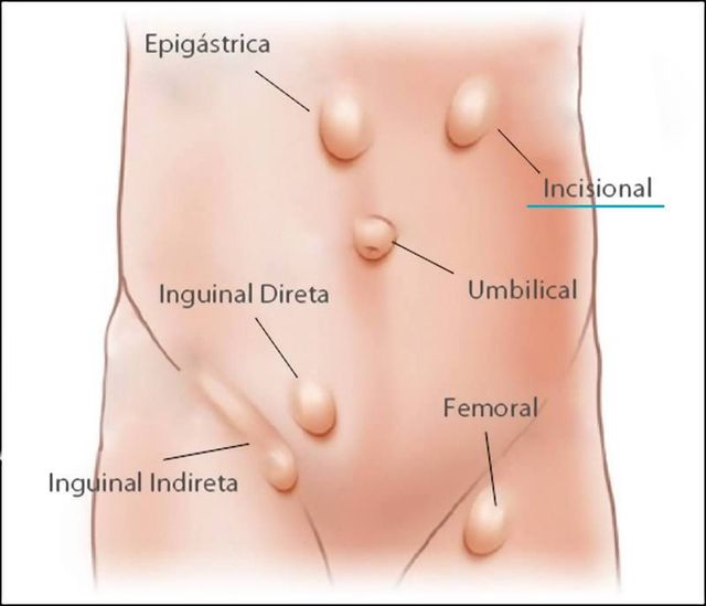 Ampliar imagem: Livance Pinheiros
