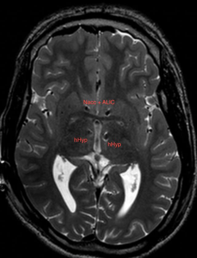 Ampliar imagem: NEUROCIRURGIA GERAL