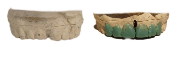 Acercar imagen: ORAL ELITE VITAL - EDIFICIO HORIZONTAL LA PLAYA INT 102