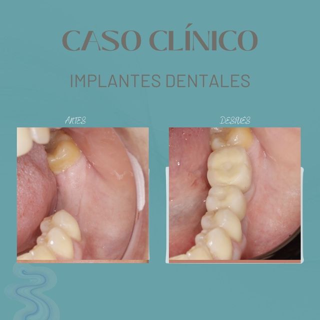 Acercar imagen: Clinica Odontológica Cenit Bulnes