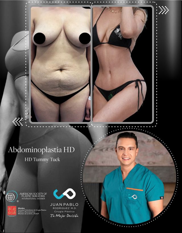 Acercar imagen: Consulta Particular