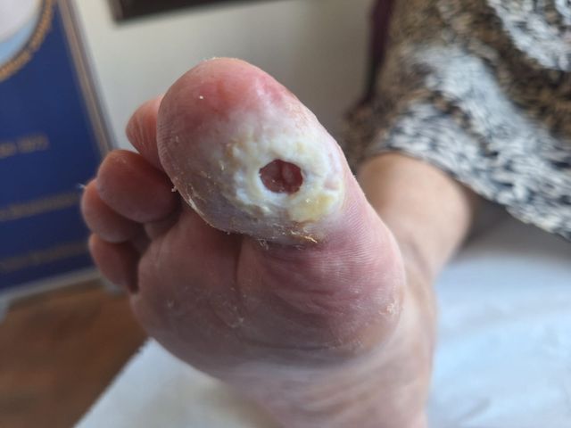 Acercar imagen: Consulta de podologia en Clini BlueMoon