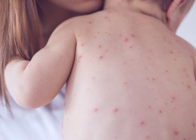 Acercar imagen: Telemedicina pediátrica