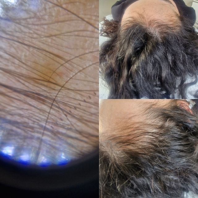 Acercar imagen: Dra Jannell Obregón - Dermatología Tu Piel