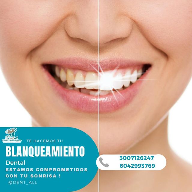 Acercar imagen: Consulta en línea