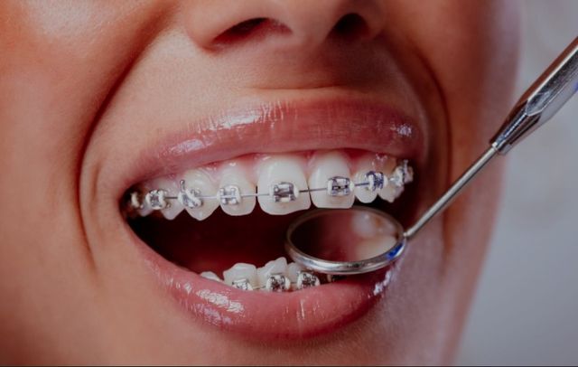 Acercar imagen: Tuboca Clinica Dental Del Caribe