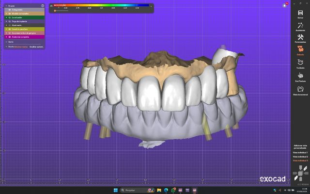 Ampliar imagem: Fernando Fister