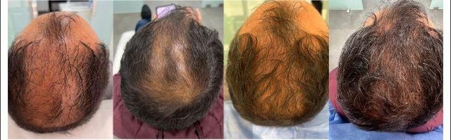 Acercar imagen: Consultas en línea