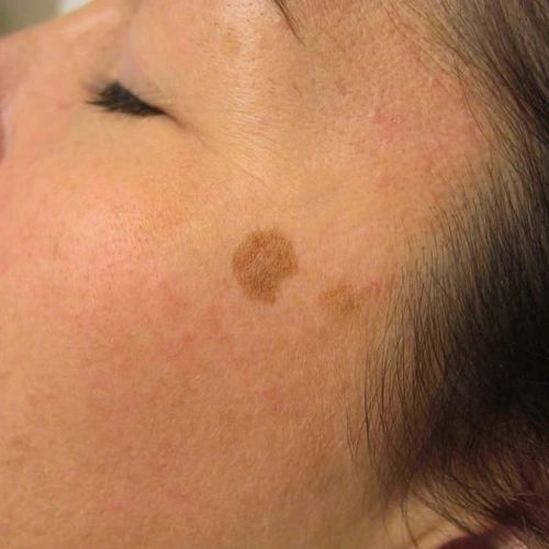 Acercar imagen: Consulta presencial