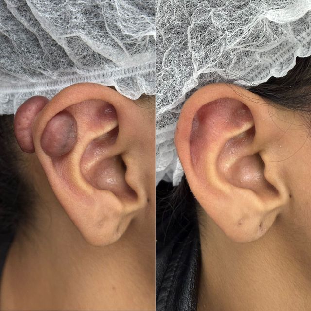 Acercar imagen: Dr Ricardo Porras - Dermatólogo -  Consultorio 1601