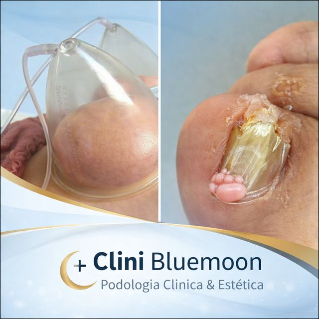 Acercar imagen: Centro estico facial y corporal y podología clínica CLINI BLUEMOON
