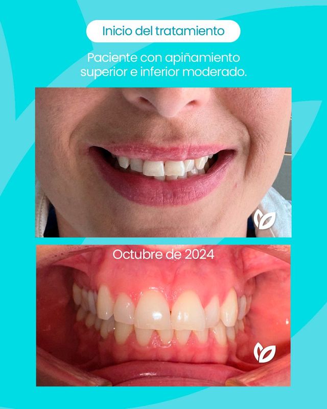 Acercar imagen: MENTTA ESTETICA DENTAL