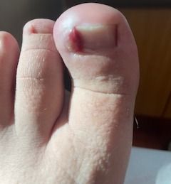 Acercar imagen: Consultas en línea