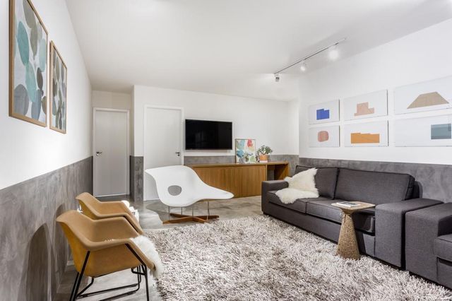 Ampliar imagem: Gaex Aligner - Aparelho invisível 