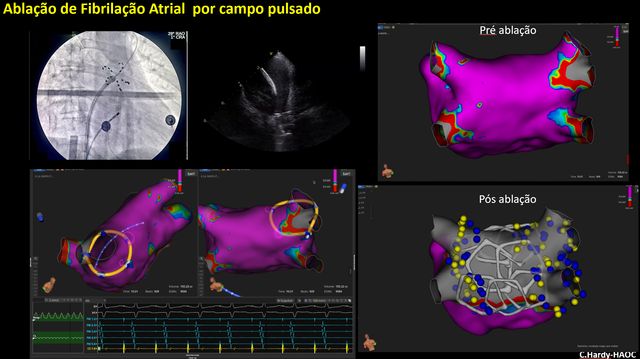 Ampliar imagem: Clinica CuoreSano - Cardiologia Geral, Arritmologia Clínica, Disautonomia, Eletrofisiologia e Estimulação Cardíaca Artificial, Reabilitação Cardiovascular.