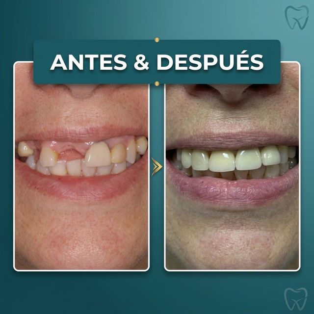 Acercar imagen: Clínica Odontológica Cenit Sucursal Hochstetter