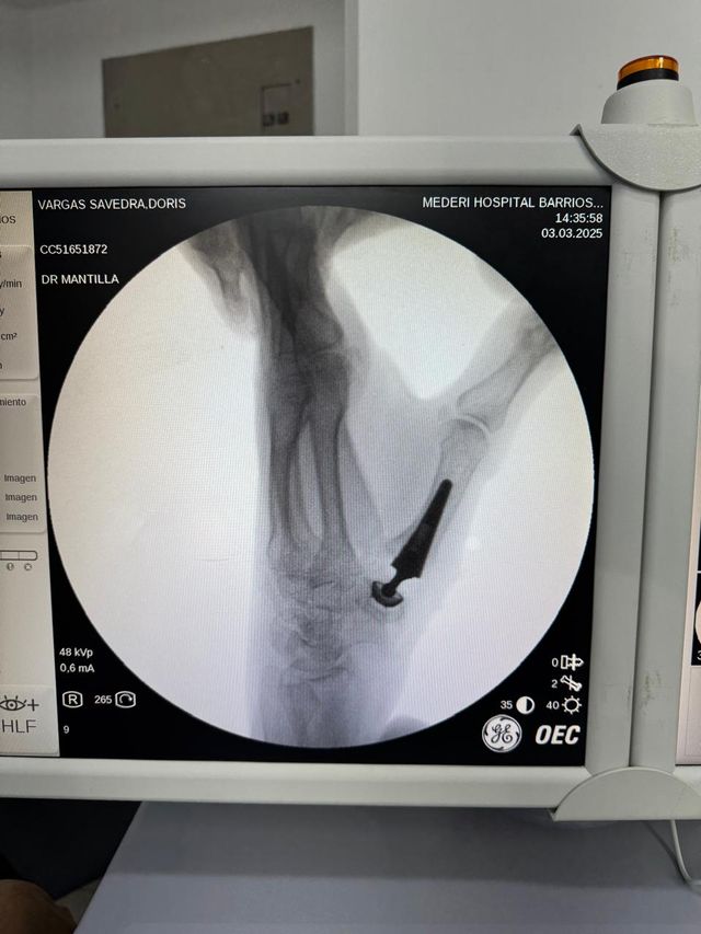 Acercar imagen: Cirugía de la Mano