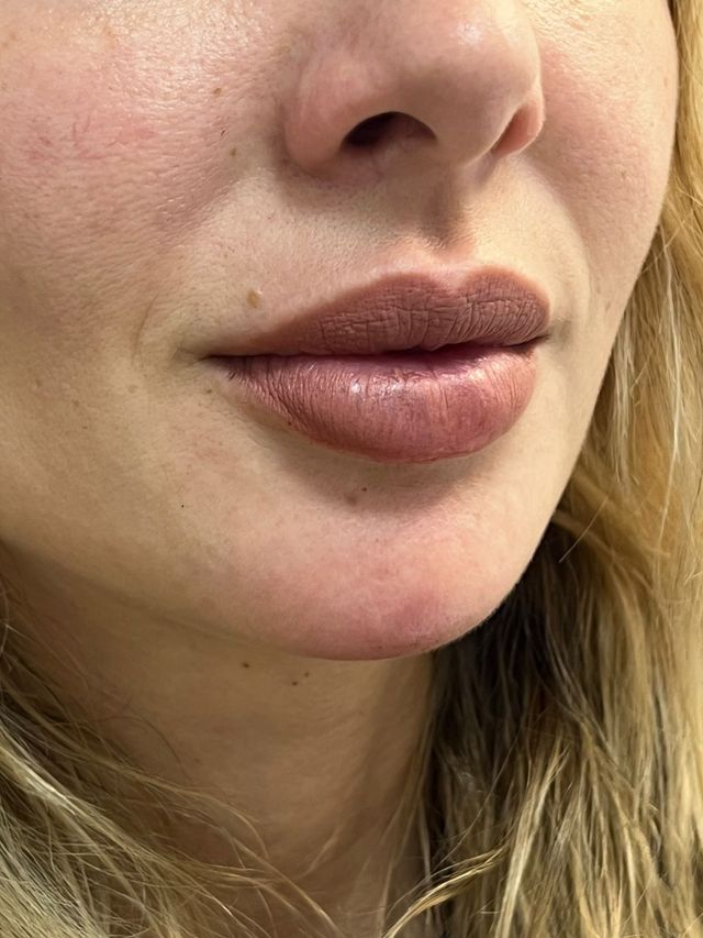 Acercar imagen: Herrera centro de medicina estética & antiage (Bogotá)