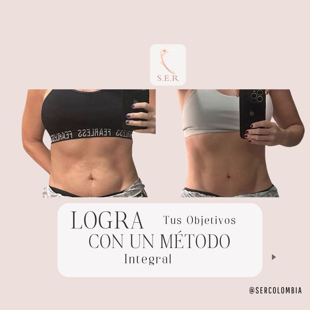 Acercar imagen: Consulta en línea