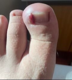 Acercar imagen: Consulta en Cirugía y Urología Infantil Dr. Carlos Zambrano - Hospital Clínico del Sur