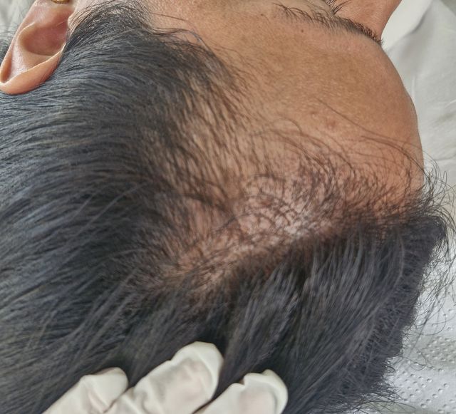 Acercar imagen: Dra Jannell Obregón - Dermatología Tu Piel