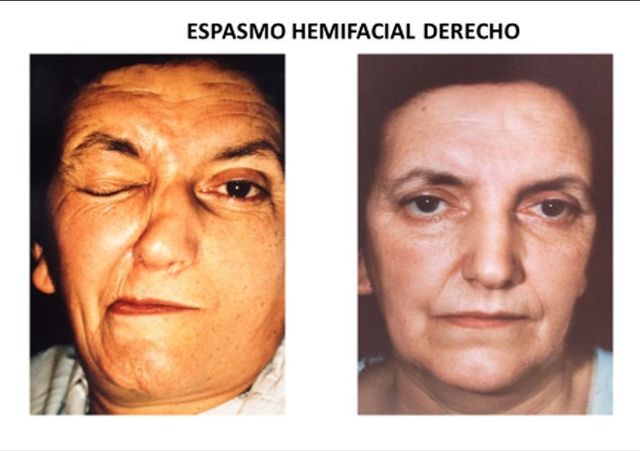 Acercar imagen: CEOLA VIÑA DEL MAR