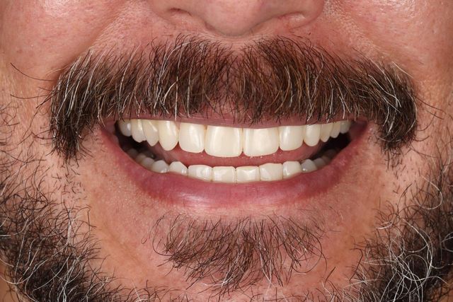 Acercar imagen: Stacy Casilimas Salud y Estética Dental