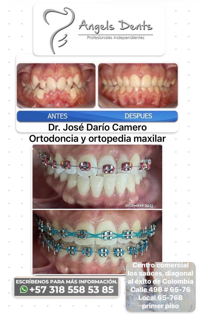Acercar imagen: ODONTOLOGIA INTEGRAL, ESTETICA DENTAL, PROTESIS