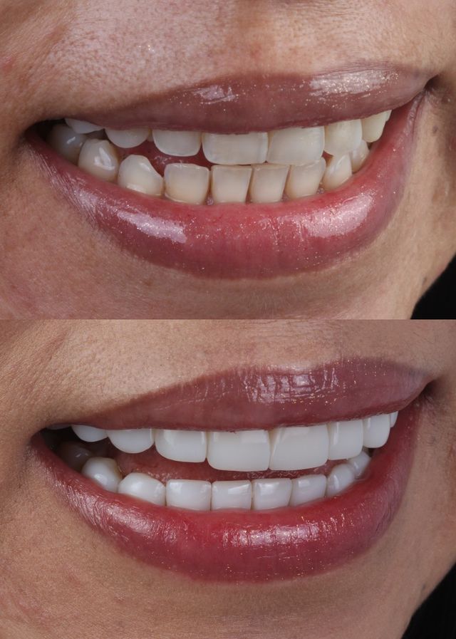 Acercar imagen: Fame dental design dr. Briggitte Wilches