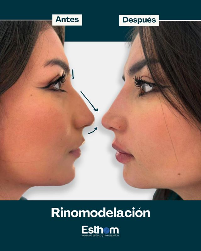 Acercar imagen: Consulta Presencial