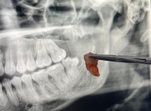 Acercar imagen: Clínica Odontológica Cenit Sucursal Hochstetter