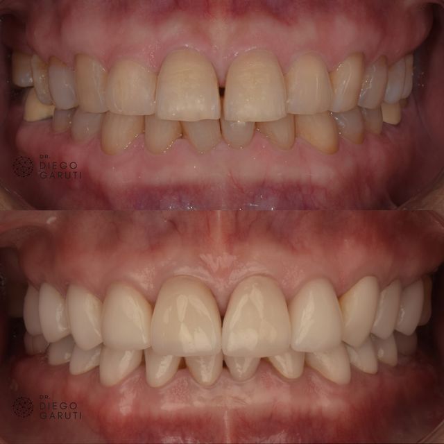 Acercar imagen: Dr. Diego Garuti