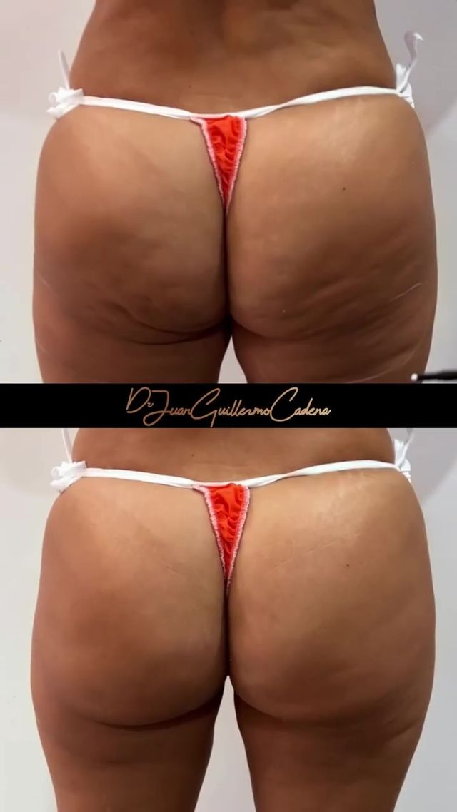 Acercar imagen: Consulta privada